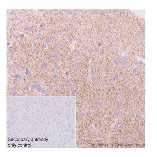 29191. RECOMBINANT ANTI-TYROSINE HYDROXYLASE ANTIBODY (EP1532Y) 100UL  ABCAM