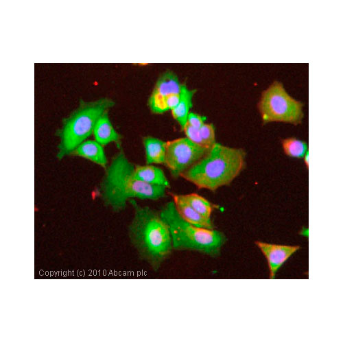 29445. ANTI-NPR-A ANTIBODY 50UL ABCAM