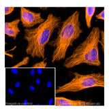 29883. DONKEY POLYCLONAL SECONDARY ANTIBODY TO GOAT IGG-H&L (ALEXA FLUOR 594) 500UG ABCAM