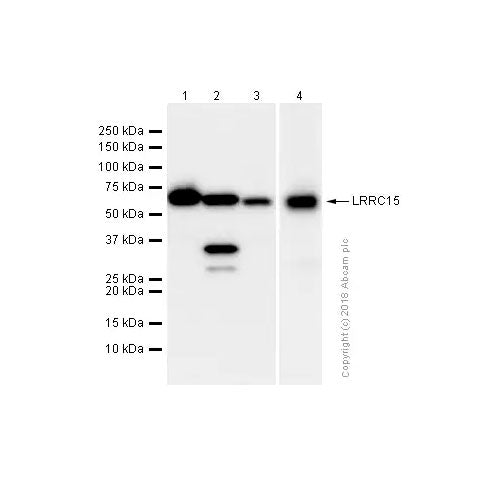 29449. RECOMBINANT ANTI-LRRC15 ANTIBODY (EPR8188(2)) 100UL ABCAM