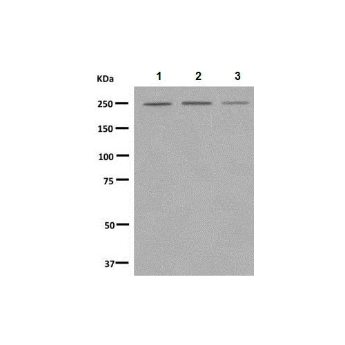 29450. RECOMBINANT ANTI-MYOSIN VIIA/MYO7A ANTIBODY (EPR7497) 100UL ABCAM