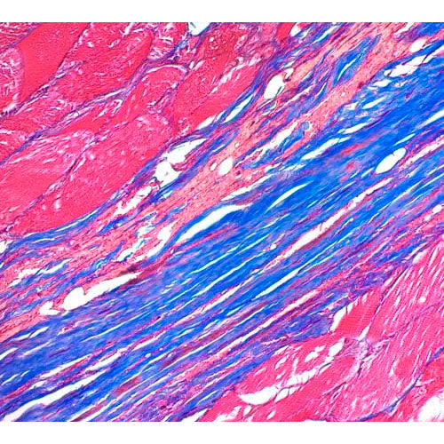 29245. TRICHROME STAIN KIT (CONNECTIVE TISSUE STAIN) 100 TESTS ABCAM