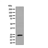 23869. RECOMBINANT ANTI-GROWTH HORMONE ANTIBODY (EPR11047(B) 100UL ABCAM