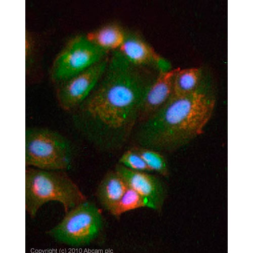 29903. ANTI-STAT5 ANTIBODY 50UG ABCAM