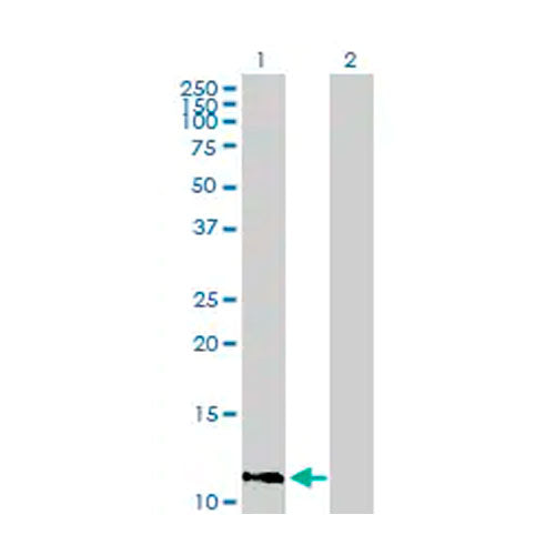 28781. ANTI-IFI27 ANTIBODY 100UG ABCAM