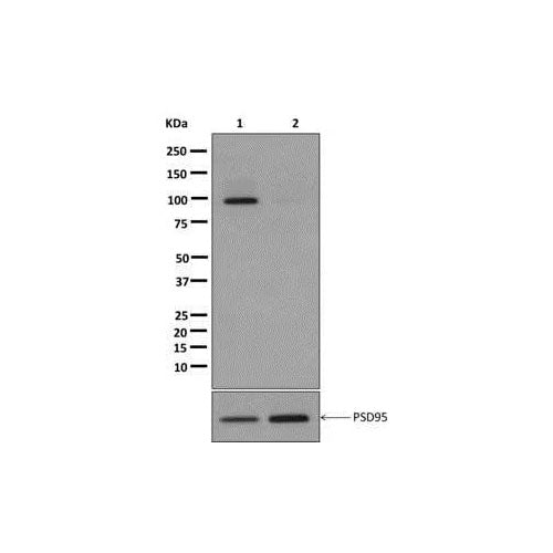 29454. RECOMBINANT ANTI-PSD95 (PHOSPHO T19) ANTIBODY (EPR2619(2)) 100UL ABCAM