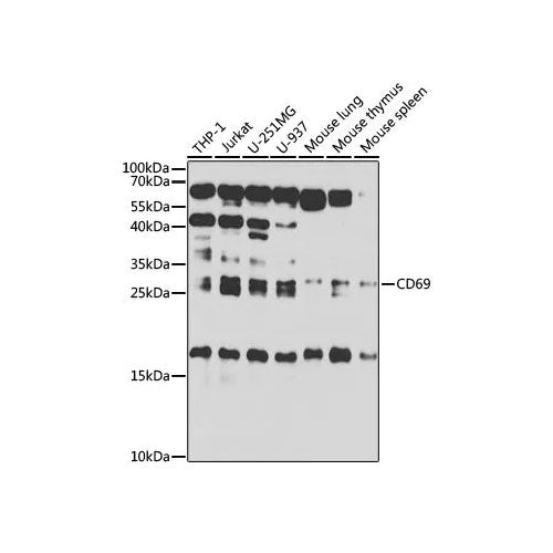 29850. ANTI-CD69 ANTIBODY 100UL ABCAM