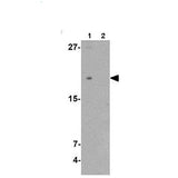 23874. ANTI-TMEM107 ANTIBODY-N-TERMINAL 100UG ABCAM