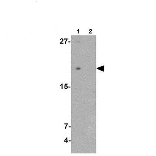 23874. ANTI-TMEM107 ANTIBODY-N-TERMINAL 100UG ABCAM