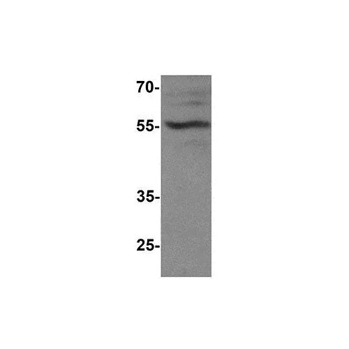 29456. ANTI-T-BET TBX21 ANTIBODY C-TERMINAL 100UG ABCAM