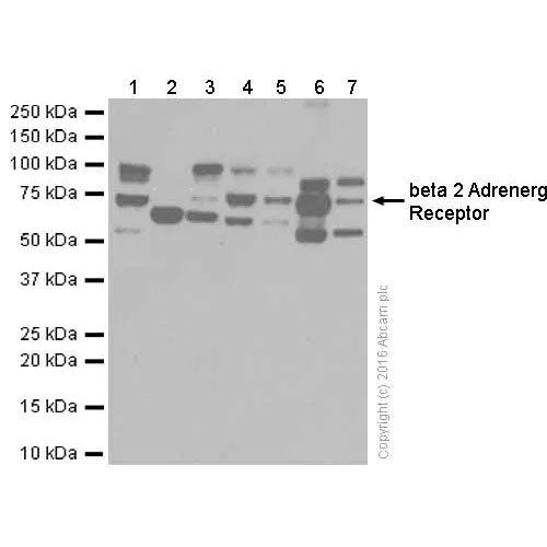 29172. RECOMBINANT ANTI-BETA 2 ADRENERGIC RECEPTOR ANTIBODY (EPR707(N)) 100UL ABCAM