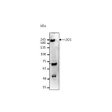 29461. ANTI-ZO1TIGHT JUNCTION PROTEIN ANTIBODY-C-TERMINAL 300UG ABCAM