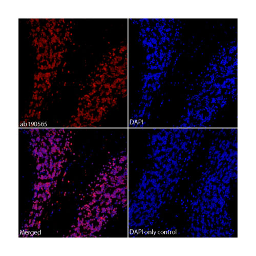 29184. RECOMBINANT ALEXA FLUOR 647 ANTI-NEUN ANTIBODY (EPR12763)-NEURONAL MARKER 100UL ABCAM