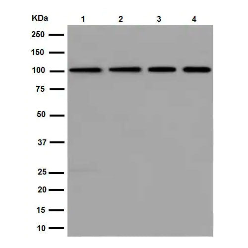 28786. RECOMBINANT ANTI-DISC1 ANTIBODY (EPR14684) 100UL ABCAM