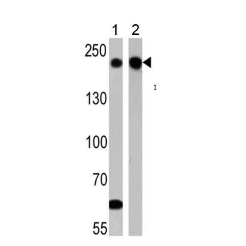 29465. MOUSE MONOCLONAL TO 200KD NEUROFILAMENT HEAVY 100UG ABCAM