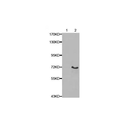29860. ANTI-LIM KINASE 1 (PHOSPHO T508) ANTIBODY 100UL ABCAM