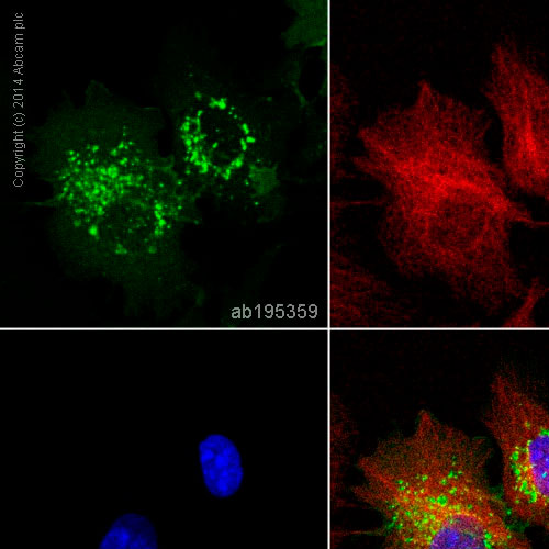 28787. RECOMBINANT ALEXA FLUOR 488 ANTI-GLUCOSE TRANSPORTER GLUT1 ANTIBODY (EPR3915) 100UL ABCAM