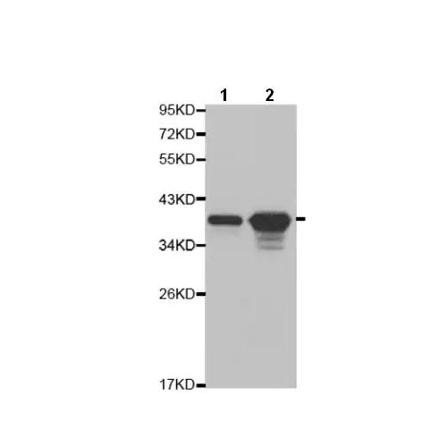 28788. ANTI-ANNEXIN A1/ANXA1 100UL ABCAM