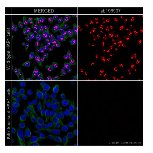 29906. RECOMBINANT ALEXA FLUOR 647 ANTI-KI67 ANTIBODY (EPR3610) 100UL ABCAM