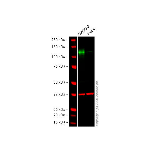29849. ANTI-CD133 ANTIBODY-STEM CELL MARKER 100UG ABCAM