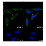 29919. RECOMBINANT ANTI-PGK1 ANTIBODY (EPR19057) 100UL ABCAM