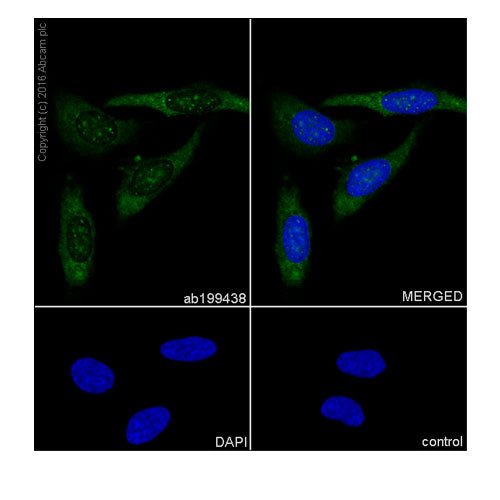 29919. RECOMBINANT ANTI-PGK1 ANTIBODY (EPR19057) 100UL ABCAM