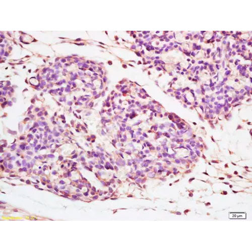 29178. ANTI-GLB1/BETA-GALACTOSIDASE ANTIBODY 100UL ABCAM