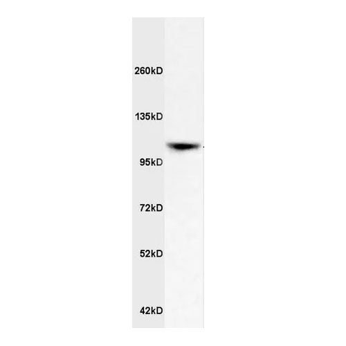 28791. ANTI-APOER2 ANTIBODY 100UL ABCAM