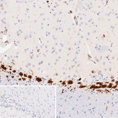 29472. RECOMBINANT ANTI-DOUBLECORTIN ANTIBODY (EPR19997) 100UL ABCAM