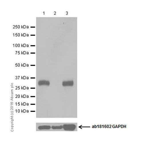 29192. RECOMBINAT ANTI-UCP1 ANTIBODY (EPR20381) 100UL ABCAM