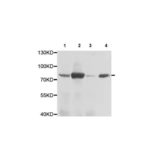 29869. ANTI-TRANSGLUTAMINASE 5/TGM5 ANTIBODY 100UL ABCAM