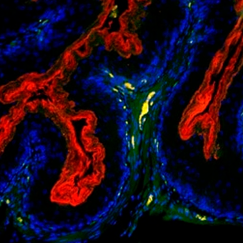 28035. ANTI-H2R ANTIBODY 100UL ABCAM