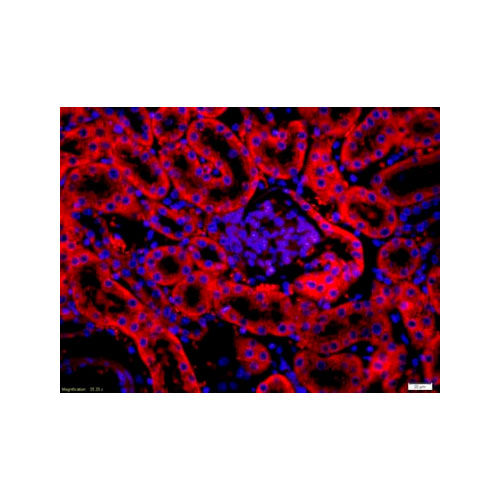 29475. ANTI-FIBROBLAST ACTIVATION PROTEIN ALPHA ANTIBODY 100UL ABCAM