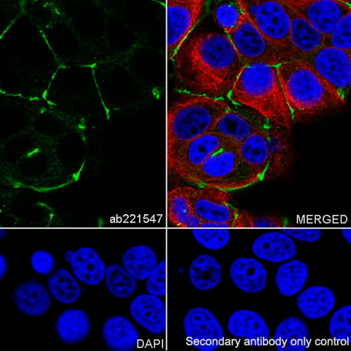 28038. RECOMBINANT ANTI-ZO1 TIGHT JUNCTION PROTEIN ANTIBODY (EPR19945-296) 100UL ABCAM