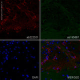 27921. RECOMBINANT ALEXA FLUOR 647 ANTI-BDNF ANTIBODY (EPR1292) 100UL ABCAM