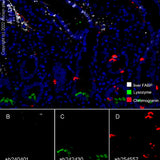 28793. RECOMBINANT ANTI-LIVER FABP ANTIBODY (EPR20464) 100UL ABCAM