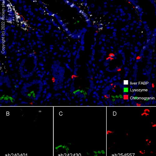 28793. RECOMBINANT ANTI-LIVER FABP ANTIBODY (EPR20464) 100UL ABCAM