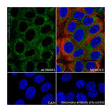 56822. RECOMBINANT ANTI-COLLAGEN III ANTIBODY (EPR17673)-BSA AND AZIDE FREE 100UG ABCAM