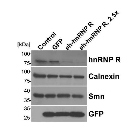 29175. ANTI-CALNEXIN ANTIBODY-ER MARKER 100UG ABCAM