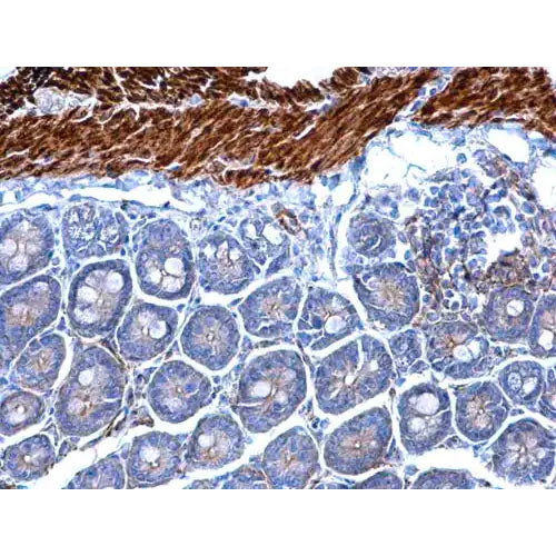 29853. ANTI-DESMIN ANTIBODY 100UL ABCAM