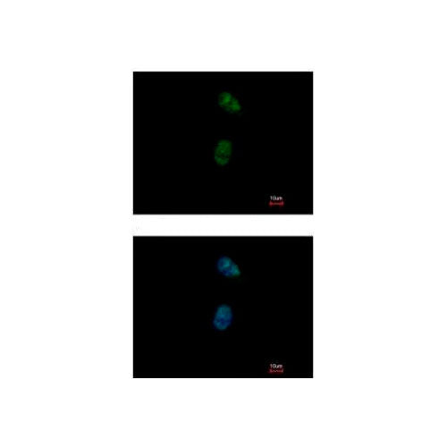 29857. ANTI-GATA4 ANTIBODY 100UL ABCAM