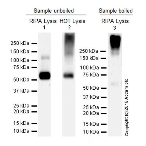 29480. RECOMBINANT ANTI-VGLUT1 ANTIBODY (EPR22269) 100UL ABCAM