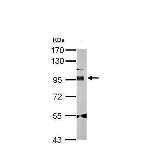 23879. ANTI-GOLGIN 97 ANTIBODY - C-TERMINAL 100UL ABCAM