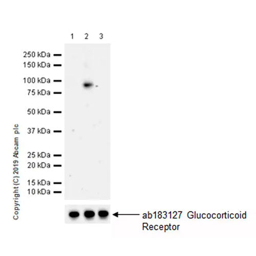 29481. RECOMBINANT ANTI-GLUCOCORTICOID RECEPTOR (PHOSPHO S226) ANTIBODY (EPR22216-414) 100UL ABCAM