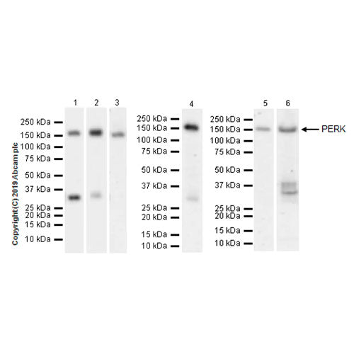 27924. RECOMBINANT ANTI-PERK ANTIBODY (EPR19876-294) 100UL ABCAM