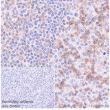 27927. RECOMBINANT ANTI-CD69 ANTIBODY (EPR21814) 100UL ABCAM