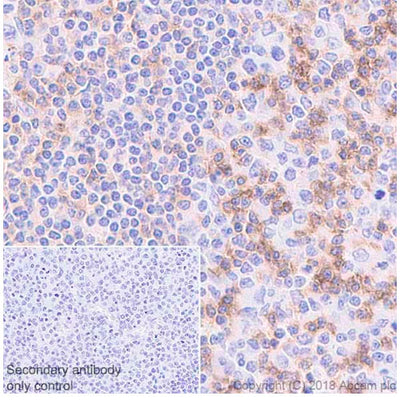 27927. RECOMBINANT ANTI-CD69 ANTIBODY (EPR21814) 100UL ABCAM