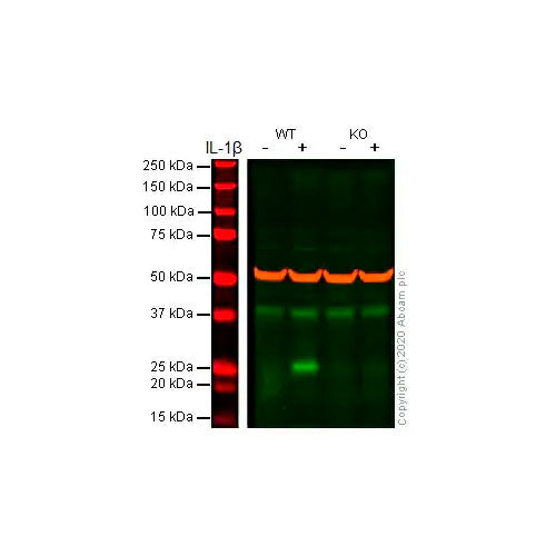 27928. RECOMBINANT ANTI-IL-6 ANTIBODY (EPR21711) 100UL ABCAM