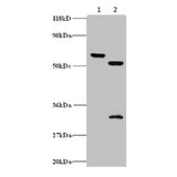 29196. ANTI-ZNF384 ANTIBODY 100UG ABCAM