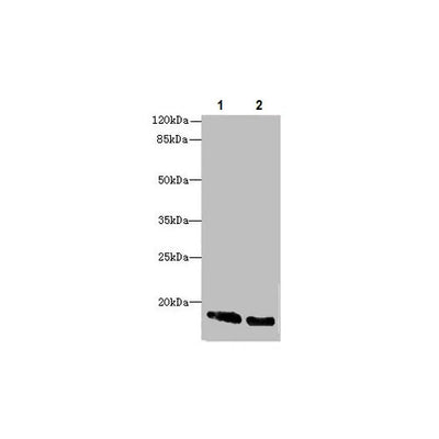 29851. ANTI-CRABP1 ANTIBODY 100UG ABCAM